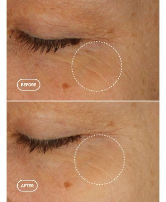 Sérum yeux rétinol-like ROOSEEL - application contour des yeux