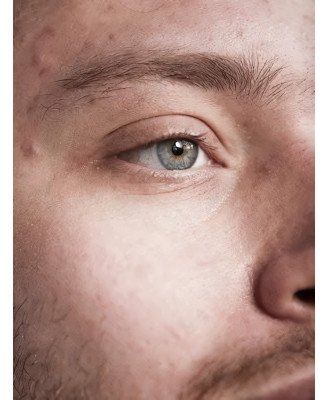Crème fluide anti-acné ROOSEEL - application visage